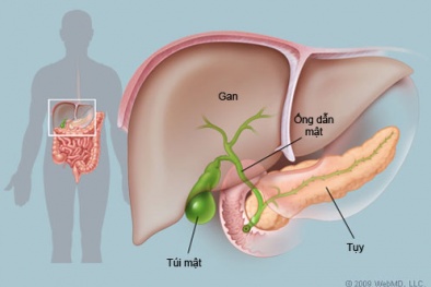 Thuốc nào giải độc gan hiệu quả?